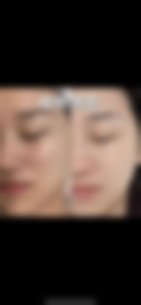 七、莲姿娜半恒久纹眉皮肤管理(福州店)常见问题解答