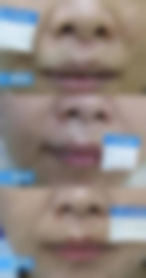 【长沙爱思特卓而美整形医疗美容门诊部诊疗项目有哪些】