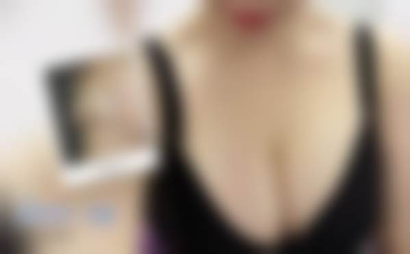 李梦莹手术风格：细腻亲和的体验