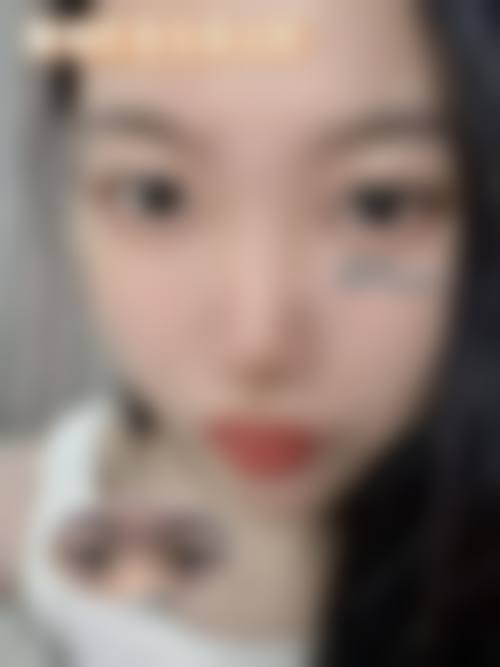 开眼角和开双眼皮常见价格区间