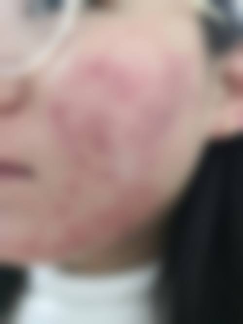 二、mellow皮肤科 清潭店是正规医院吗?正规资质查阅