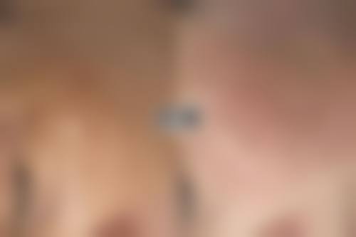 九、患者常见问题解答(精选)