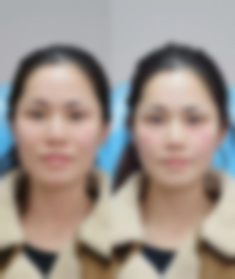 傅崇华医生口碑评价及真人实例