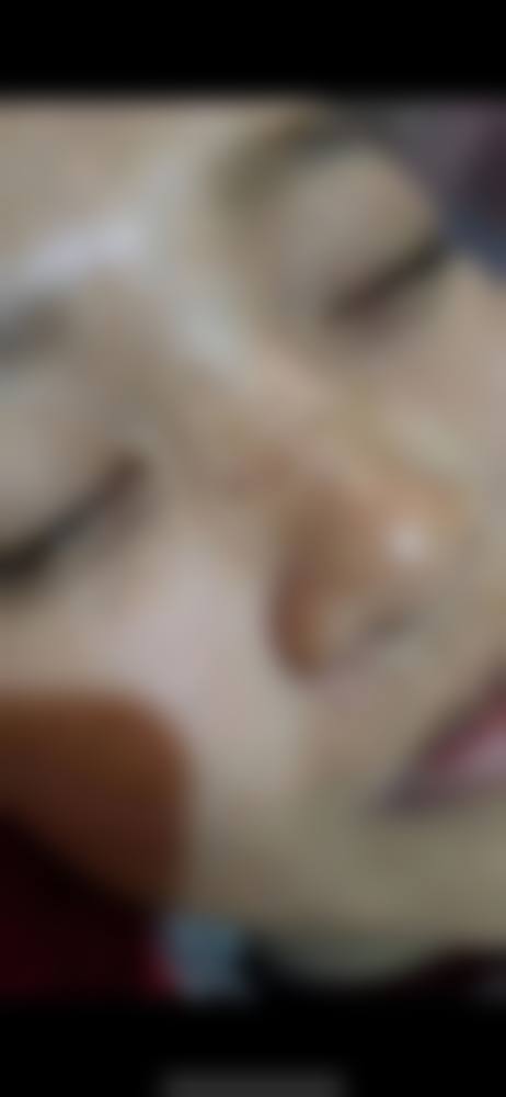 武汉甄美整形医疗美容门诊部价目表