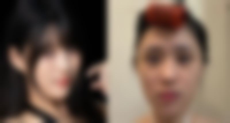 手术成效：自然、原生、和谐