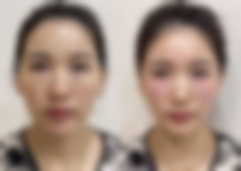 沈阳蒂美整形真人口碑评价怎么样？