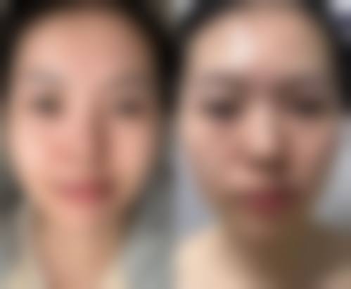日常护理改善眼袋挖多状况