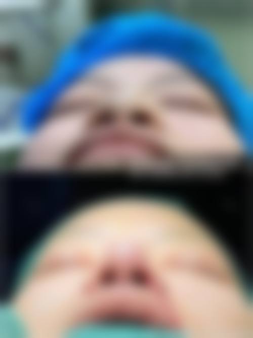 必看！深圳市人民医院整形外科价格表大公开，多项目价格与技术亮点全揭秘 