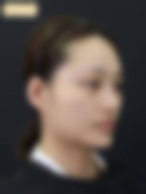 结论:正确选择下颌骨整形科室