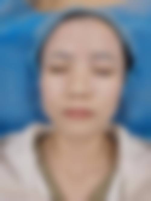 昆明卉颜整形医疗美容门诊部收费价格表