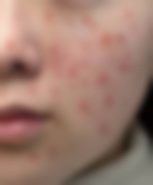 吕影医生预约挂号