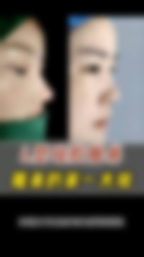 韩国4ever整容外科口碑怎么样？