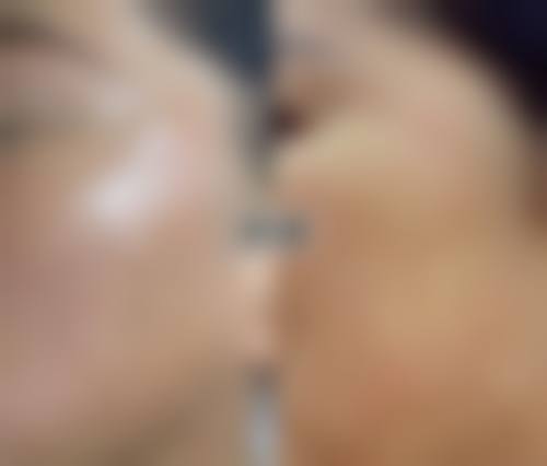 吕影医生技术优势