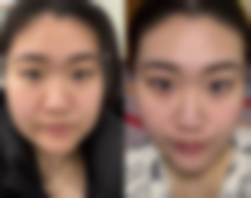 不同情况选择的下颌骨整形科室