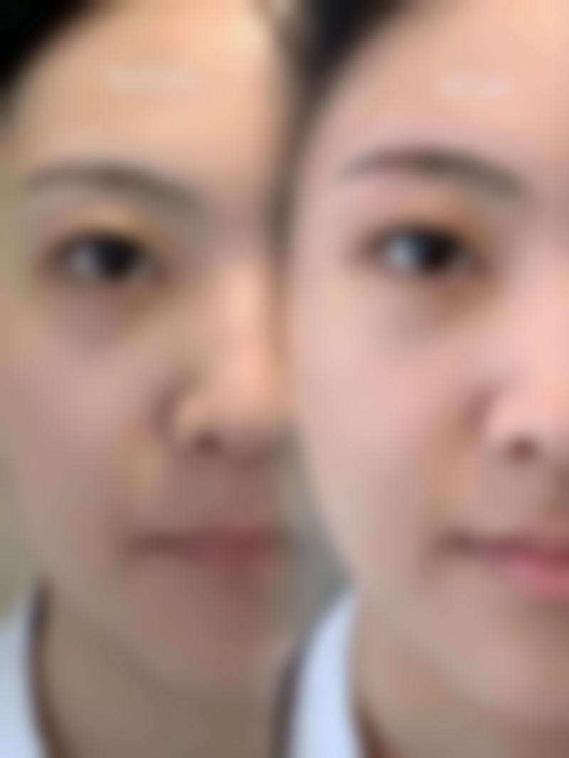 下颌骨整形科室选择的注意事项