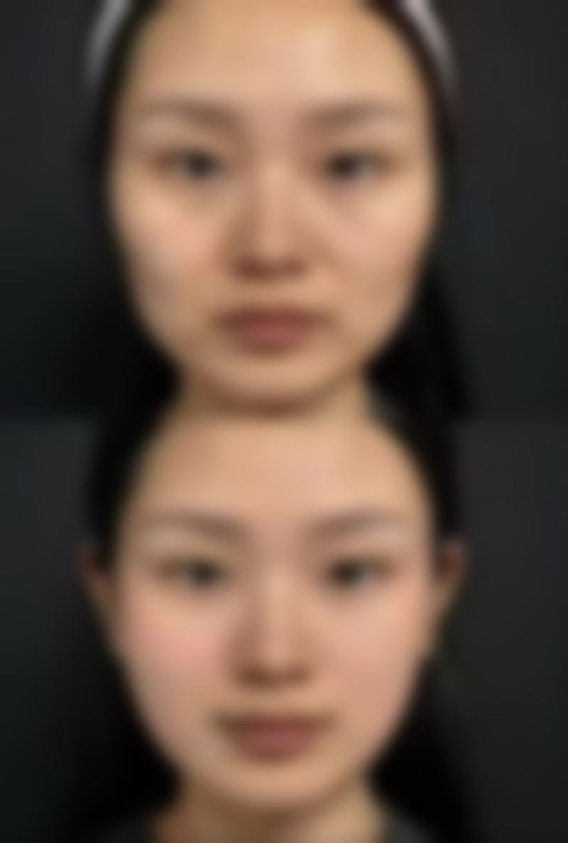 湖北恩施美年华整形医院项目价格参考