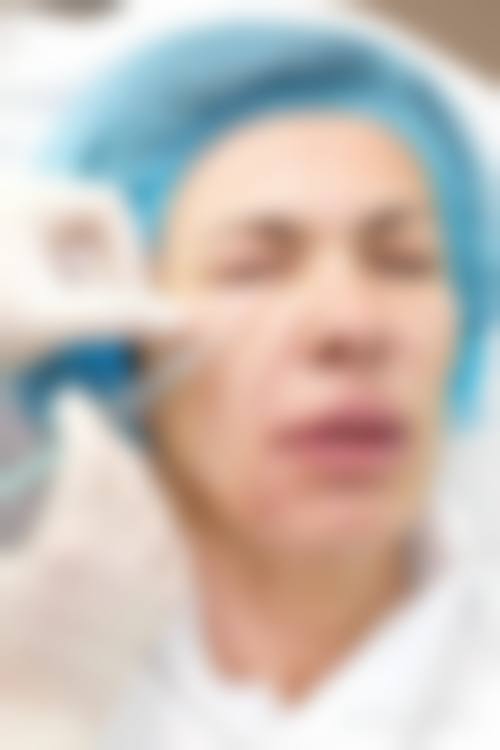 恒力瘦脸针的适用人群