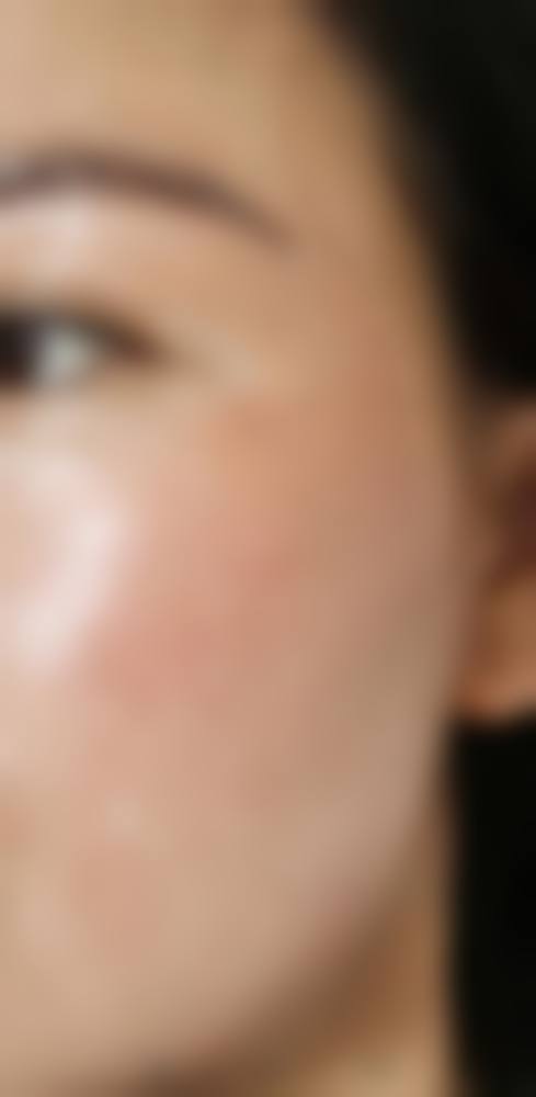 上海俏佳人医疗美容门诊部如何预约?