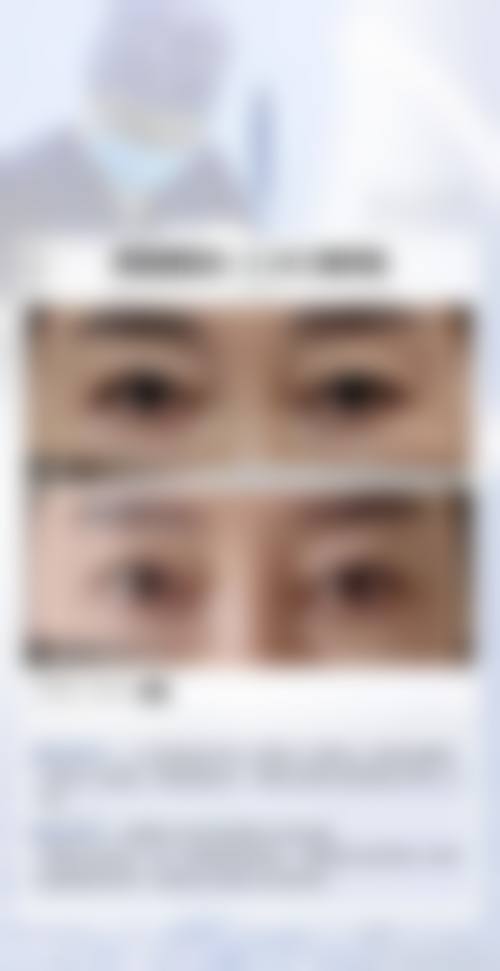 炎症感染引发眼皮肿
