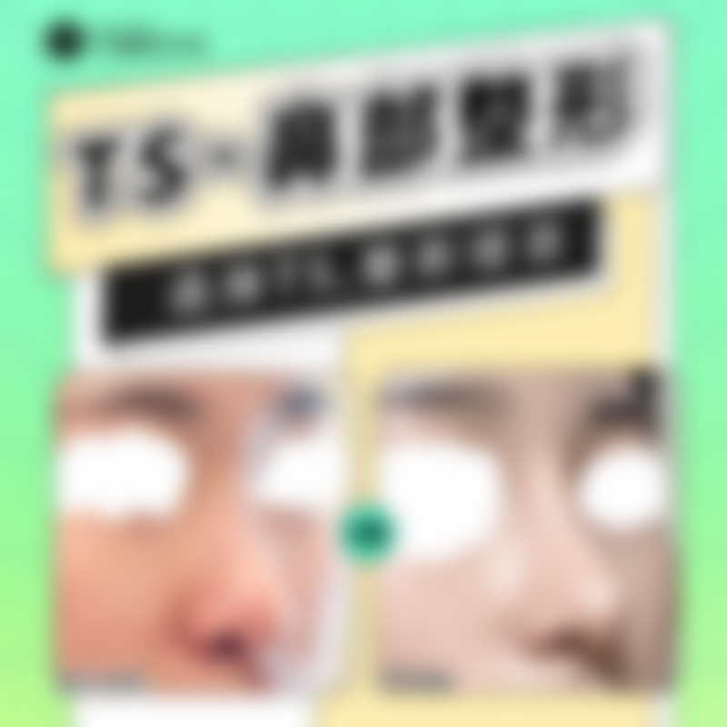 韩国TS整形医院李昇燦是渠道医生吗？揭秘其初鼻/鼻修复技术，看真人案例见证自然美鼻效果！ 