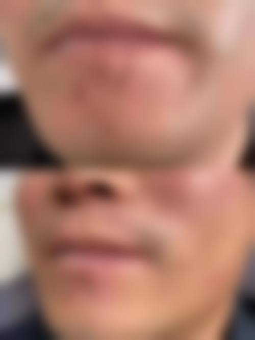 二、北京京城皮肤医院祛疤的技术优势