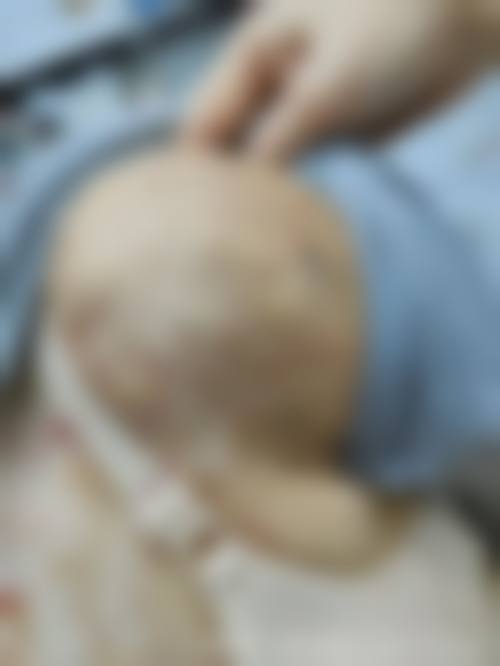 手术治疗方案