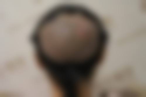 北京科发源植发医疗美容医院特色项目及技术优势