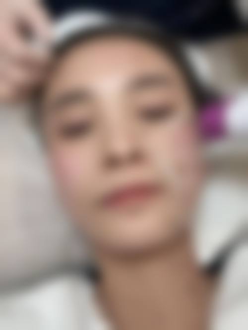 二、抗衰项目价格
