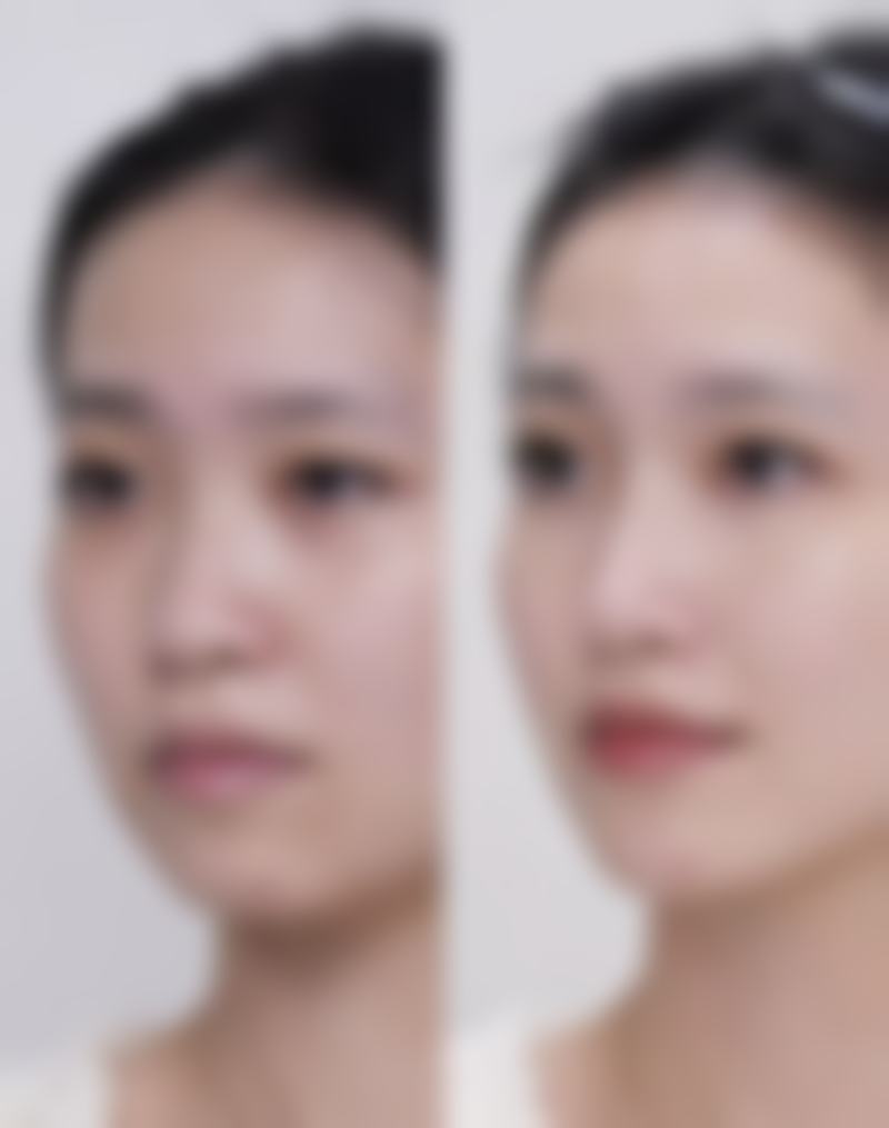 上海喻德军美容整形外科诊所收费贵吗？