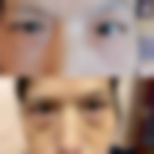 用鸡蛋滚眼睛去眼袋的操作注意事项
