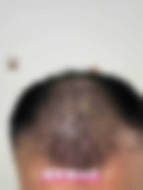 上海瑞丽诗植发医院真人口碑评价怎么样?