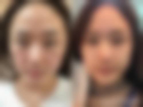 2026北京筋膜提升好的医院排名揭晓，加减美、联合丽格等凭技术实力上榜！ 