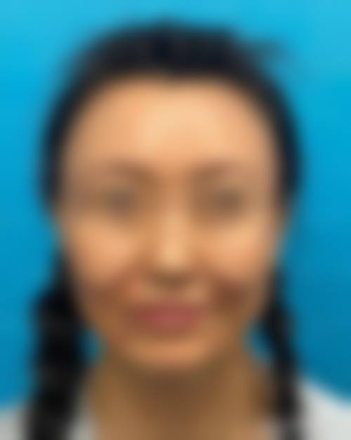四、选择医院的实用建议
