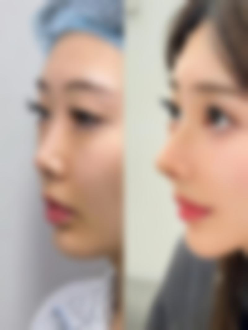 南京千秀美珏医疗美容诊所价格表/收费标准一览