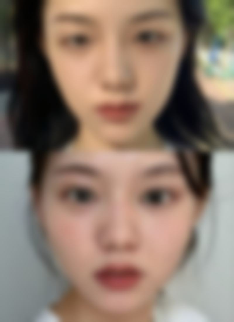 上海颜净赵鹏医生评价：口碑稳技术优，筋膜悬吊、鼻修复等项目备受称赞！ 