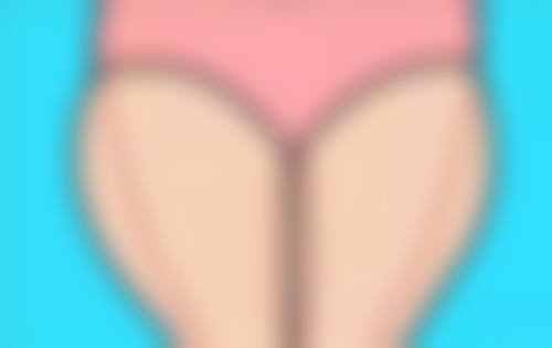 无创双眼皮的具体操作过程