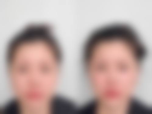 北京叶美人整形医院简介