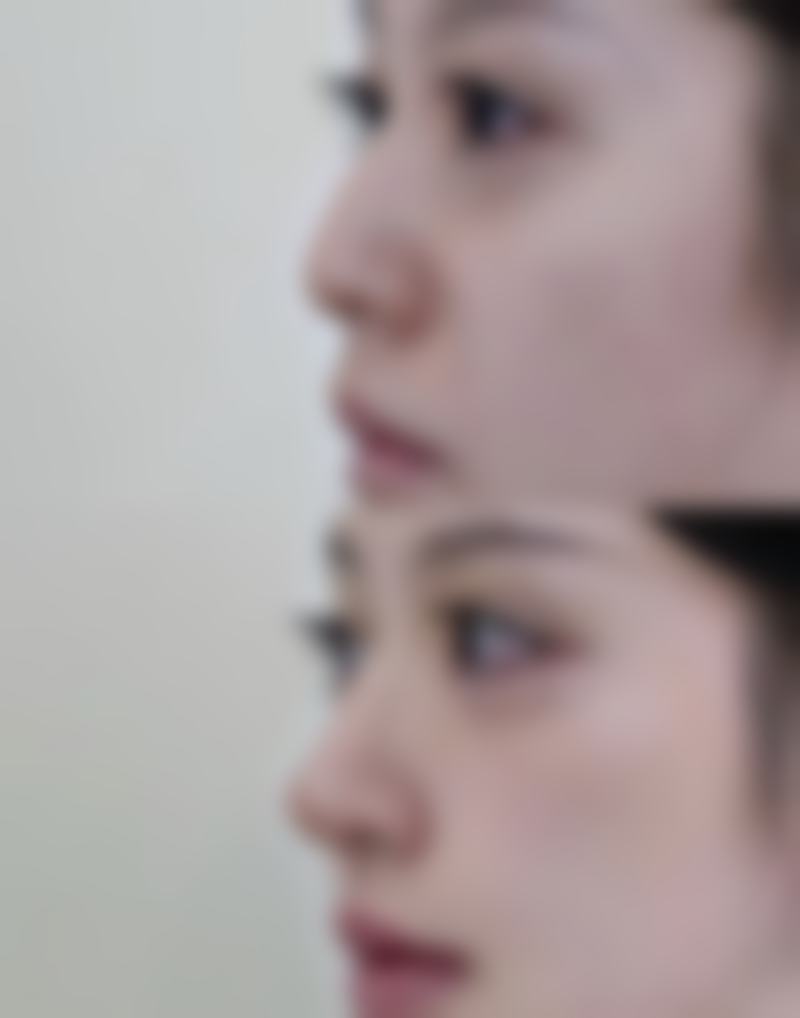 吉安艺星医疗美容医院价目表