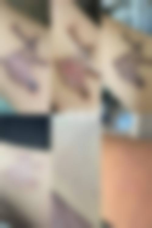 深圳容术医疗整形美容患者真实反馈回答口碑怎么样?