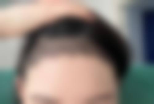 重庆德艺阿兰医疗美容门诊部特色项目及技术优势