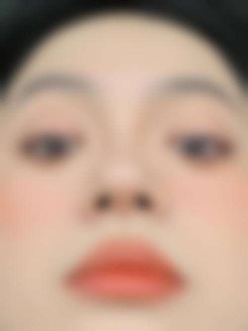超皮秒设备在南方医 科 大学南方医院祛斑中的作用