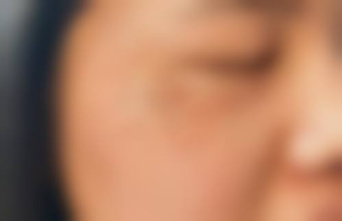 南方医 科 大学南方医院祛斑的医生团队有多牛