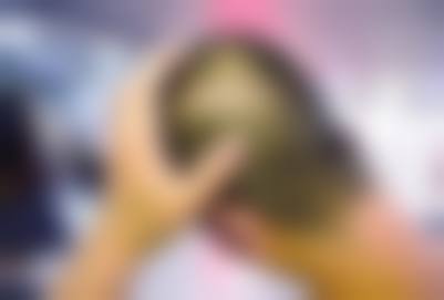 🔍长春韩尚植发的项目