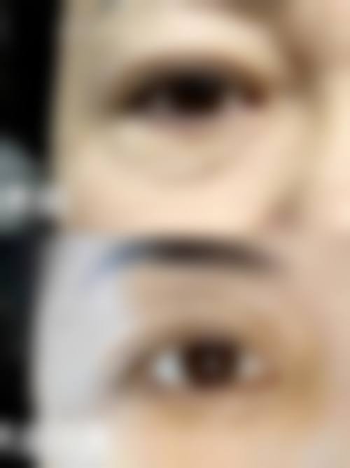 选择双眼皮修复机构和医生的要点
