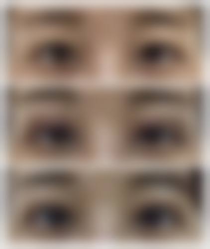 眼部整形骨干医生曹智慧