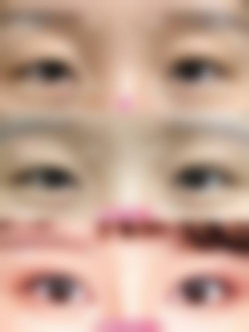安禾美阁出名的三个医生是谁？曹智慧眼部整形、苏斌抽脂塑形、夏志冉面部提升超厉害！ 
