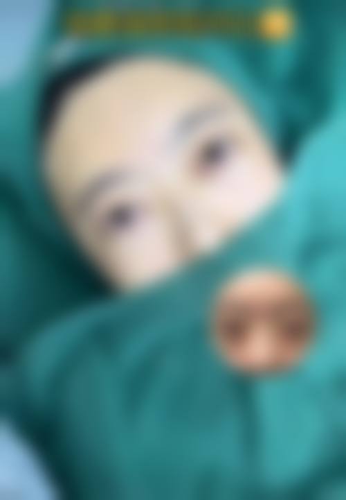 非手术治疗去除眼袋