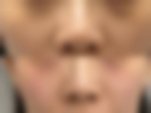 上海九院面部整形项目价格
