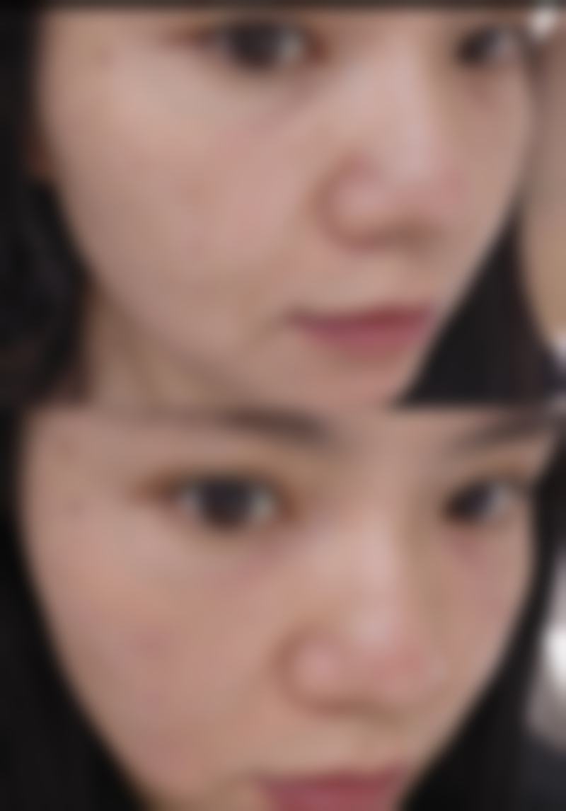 打了瘦脸针1周后的锻炼建议