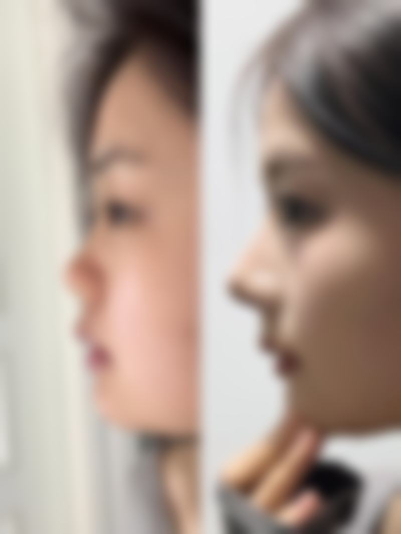 包头马登峰医疗美容诊所预约方式